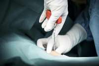 В Красноярске будут проводить трансплантацию костного мозга