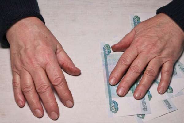 В Госдуме предложили ввести новое ежегодное пособие для пенсионеров